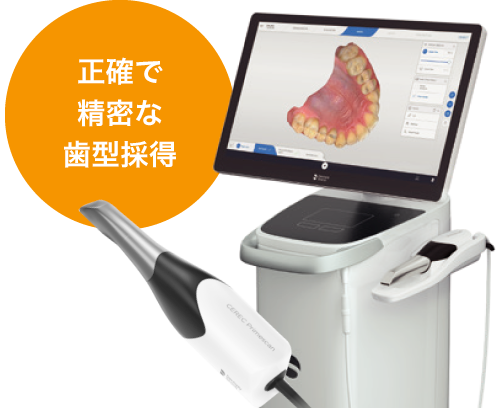 正確で精密な歯型採得
