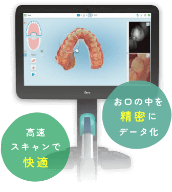 高速スキャンで快適・お口の中を精密にデータ化