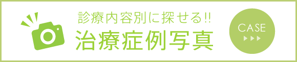 診療内容別に探せる！！ 治療症例写真